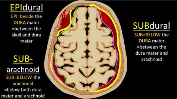 What is above the dura