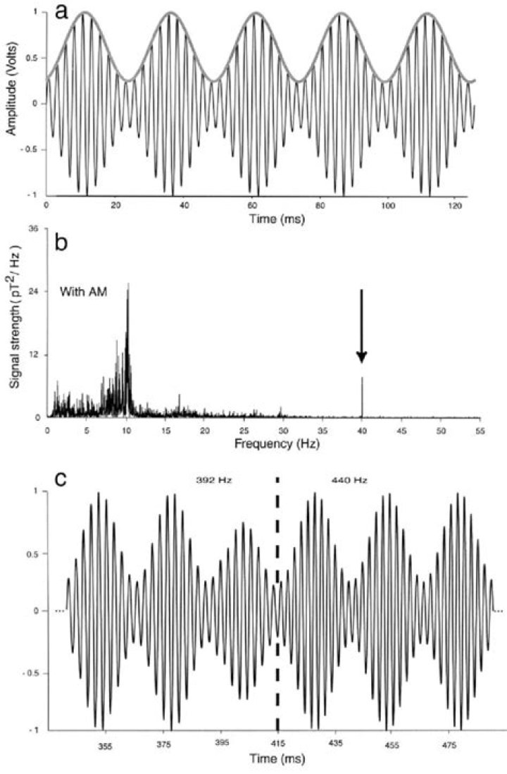 What is auditory steady state response