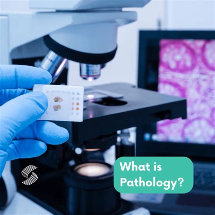 What is CD in pathology