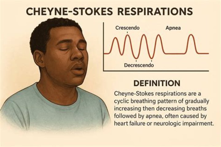 What is Cheyne Stokes breathing pattern