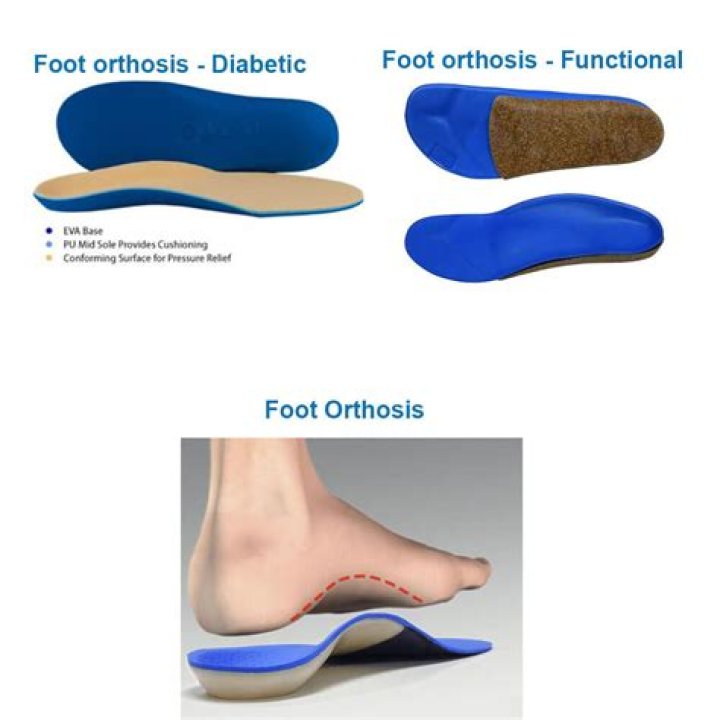What is foot orthosis? | ContextResponse.com
