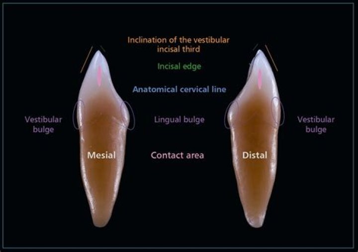 What is mesial root