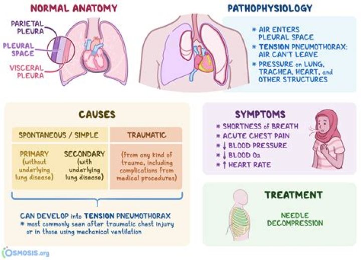 What is the difference between a pneumothorax and a Hemothorax