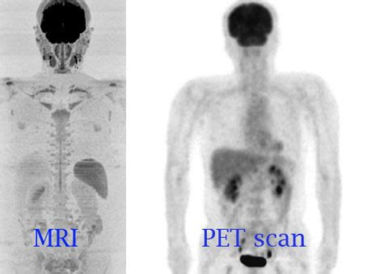 What is the difference between an MRI and a PET scan?