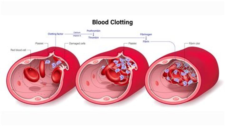 What is the medical term that means abnormal condition of clotting cells