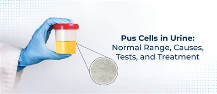What is the normal range of pus cells in stool?