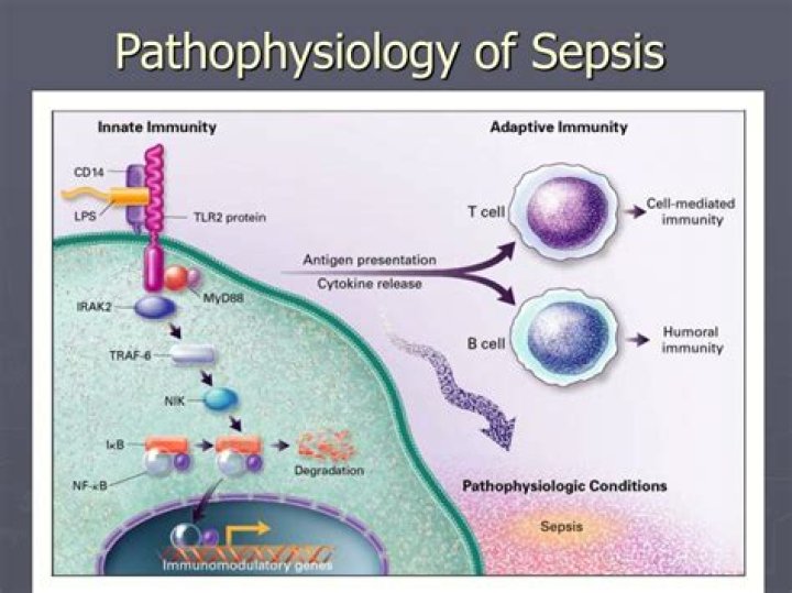 What is the pathophysiology of sepsis?