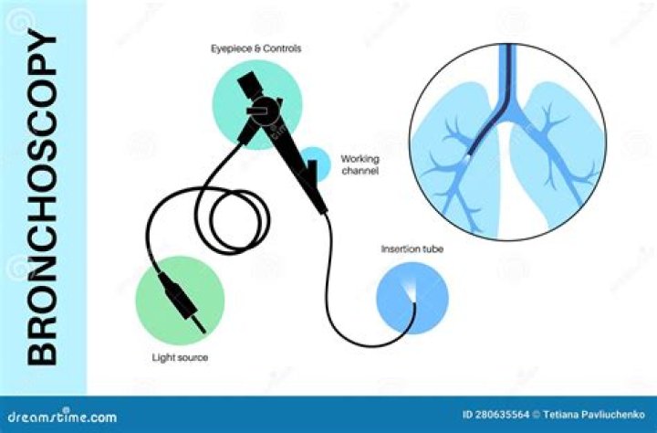 What is the purpose of bronchoscopy
