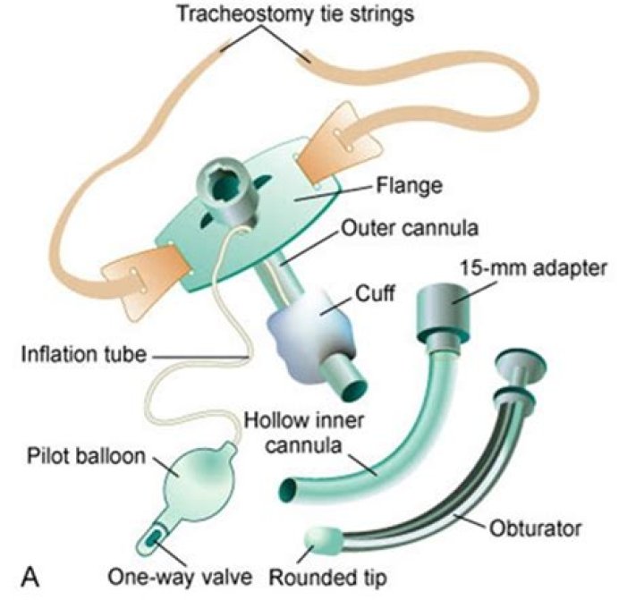 What is the purpose of the inner cannula on a tracheostomy
