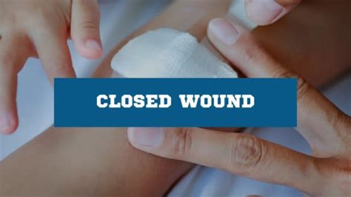 What is the signs and symptoms of a closed wound