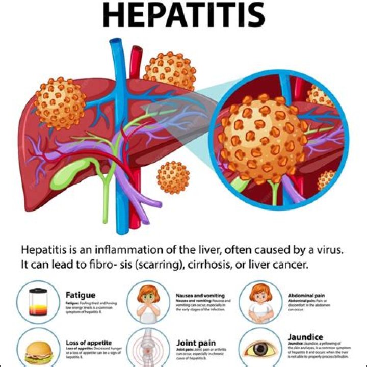 What kind of virus is hepatitis