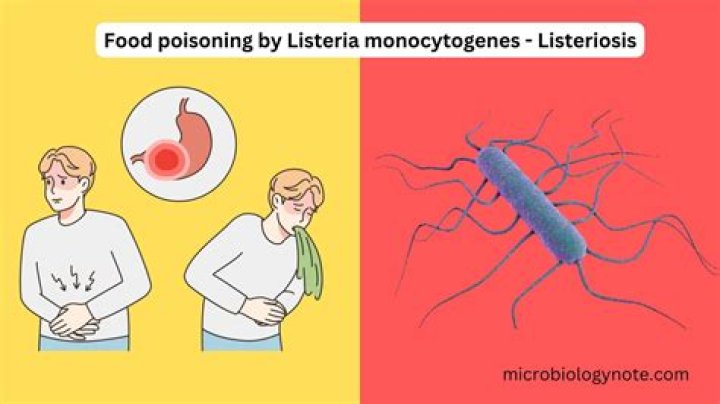 What type of bacteria is Listeria?