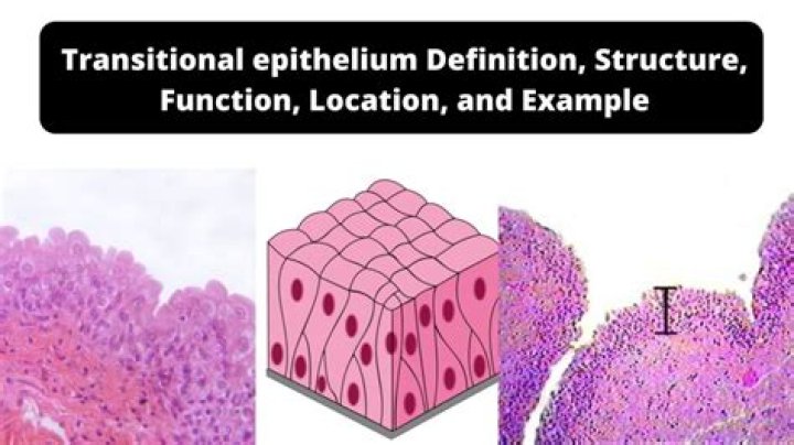 What type of epithelium is transitional epithelium