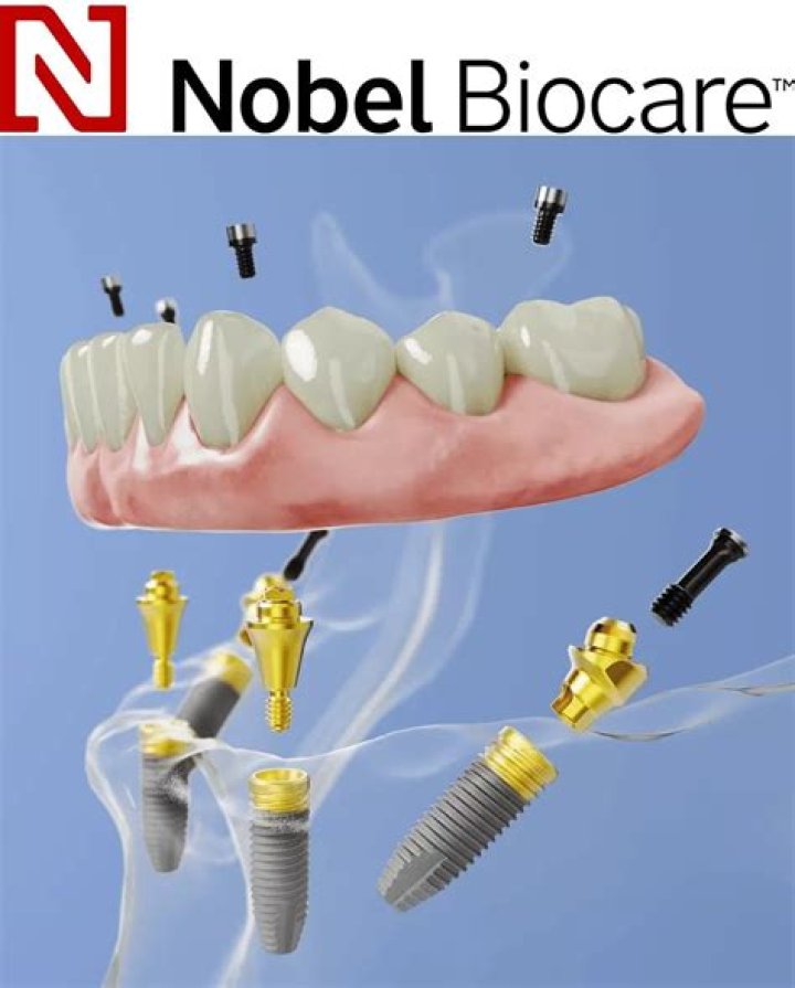 Where are Nobel Biocare implants made?