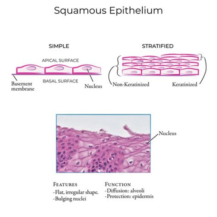 Where does squamous cell originate