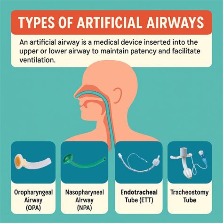 Which artificial airway is used for long term airway
