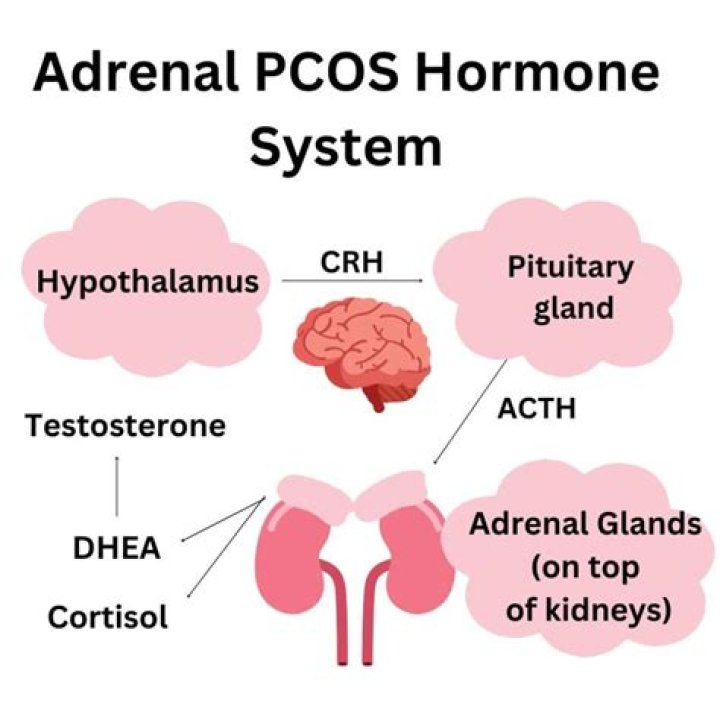 Which hormone is high in PCOS