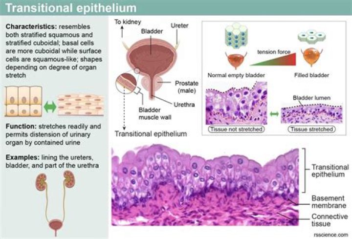 Which of the following is the type of epithelium that lines the urinary tract