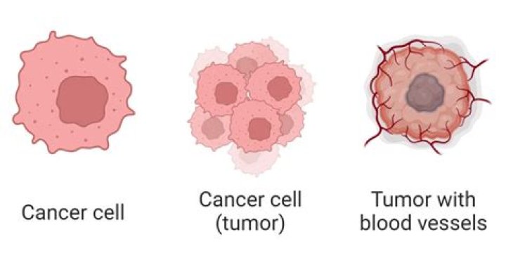 Which term means cancerous tumor?