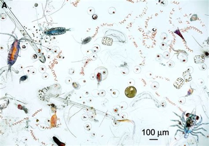 Who discovered free living cell in pond water
