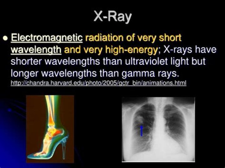 Why are low energy X rays removed