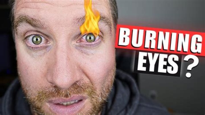 Why do onions burn eyes?