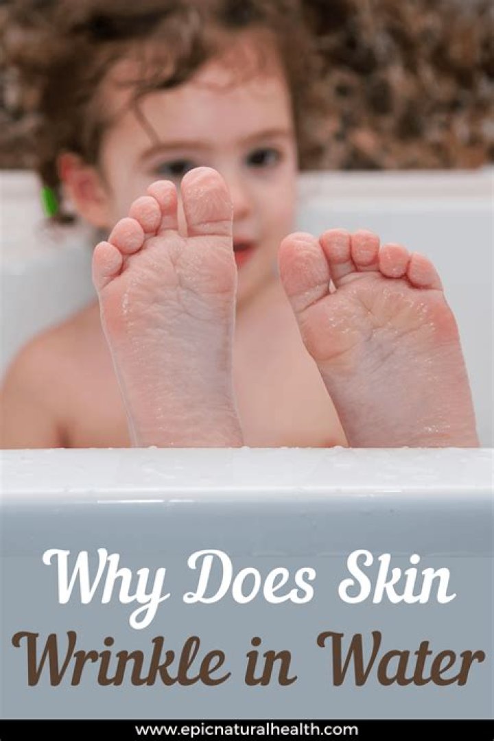 Why does your skin get pruney in water