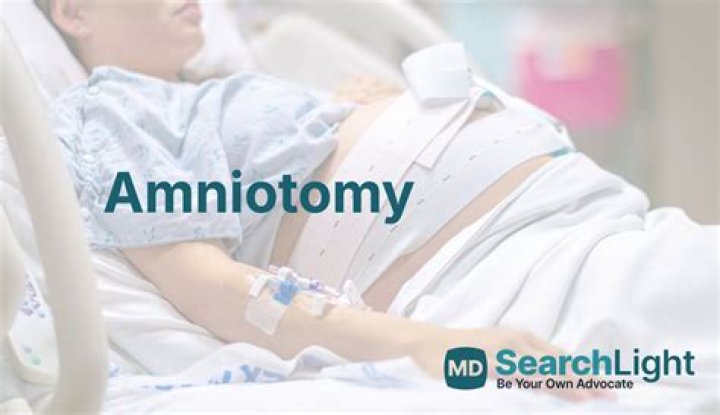 Why is an Amniotomy performed